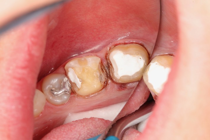 Ted Kanamori #18-19 prep