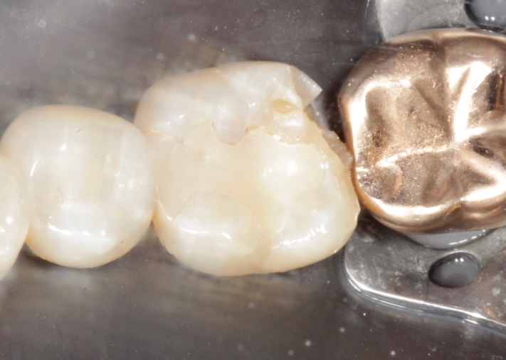 Ted Kanamori #19 pre-op