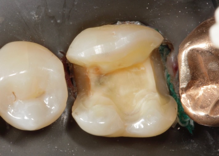 Ted Kanamori #19 prep