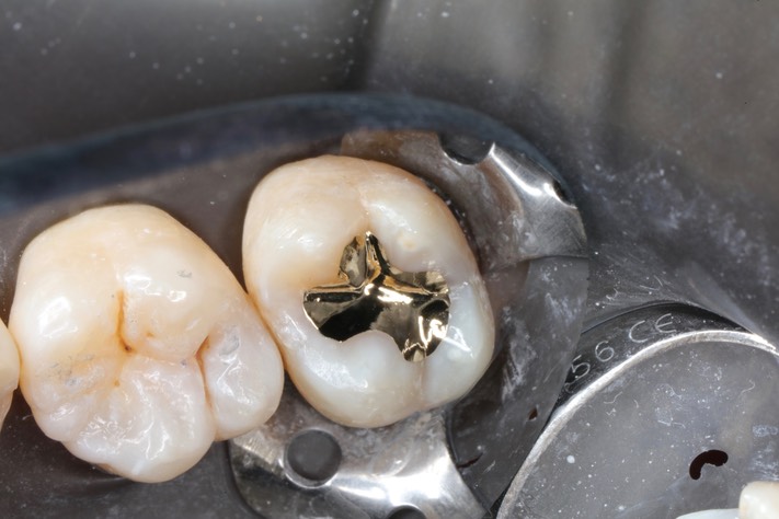 Ted Kanamori #2 finish