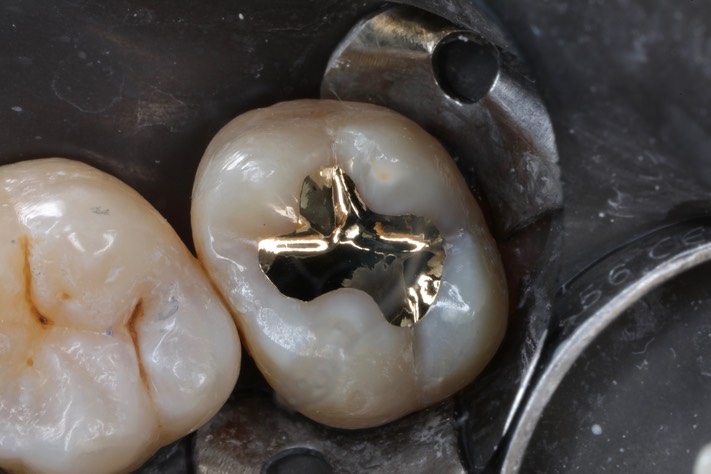 Ted Kanamori #2 finish