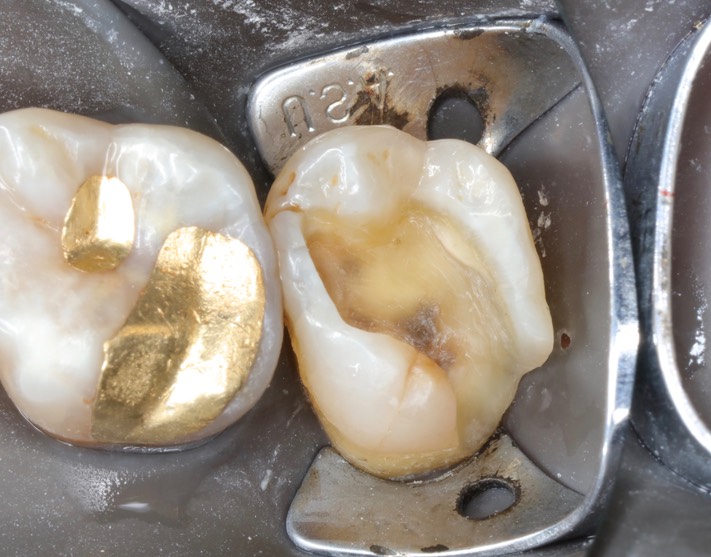 Ted Kanamori #2 prep 