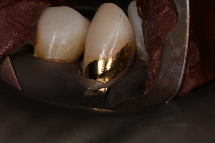 Ted Kanamori #27 finish 1