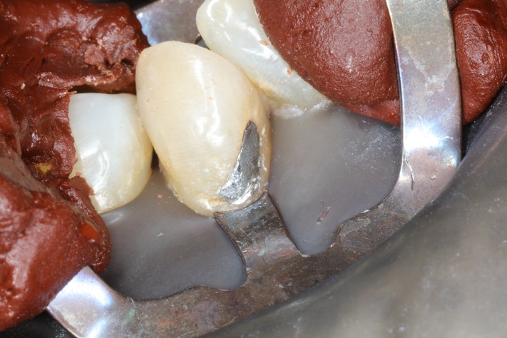 Ted Kanamori #27 pre-op