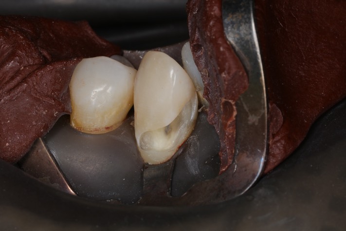 Ted Kanamori #27 prep