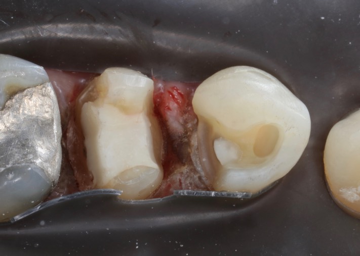 Ted Kanamori #28-29 prep