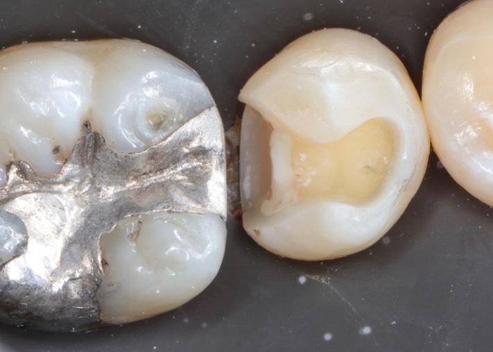 Ted Kanamori #29 prep