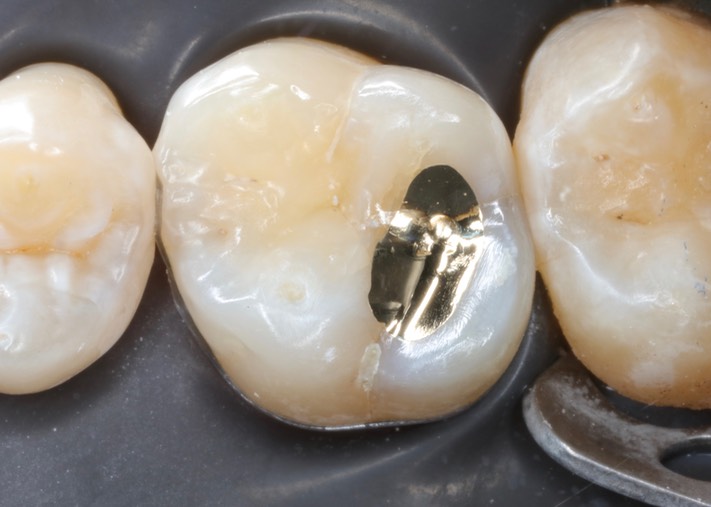 Ted Kanamori #3 finish