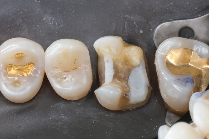 Ted Kanamori #3 prep