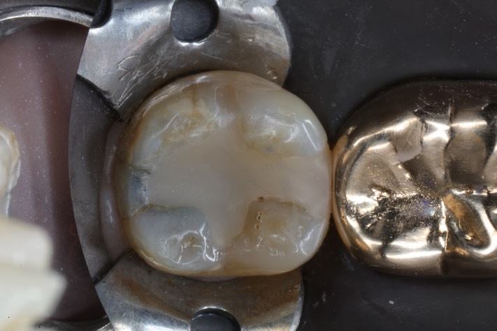 Ted Kanamori #30 pre-op