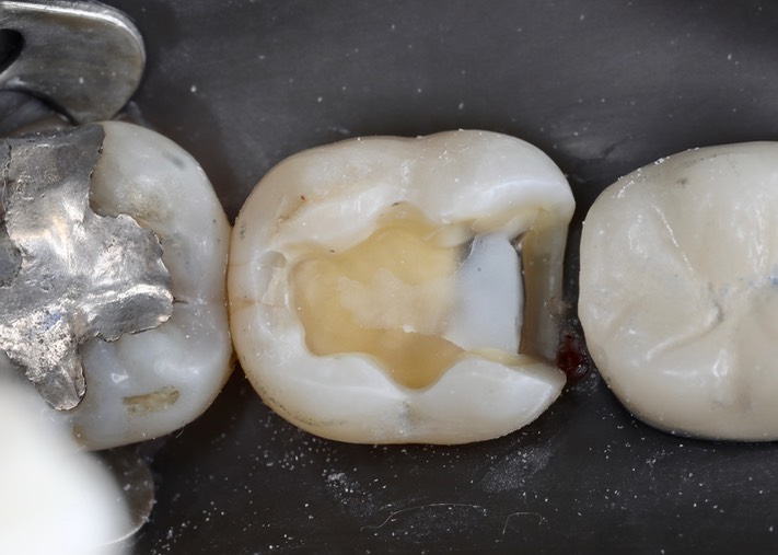 Ted Kanamori #31 prep