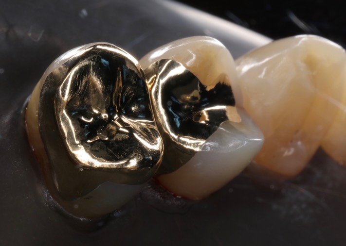 Ted Kanamori #4-5 finish