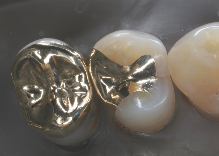 Ted Kanamori #4-5 finish