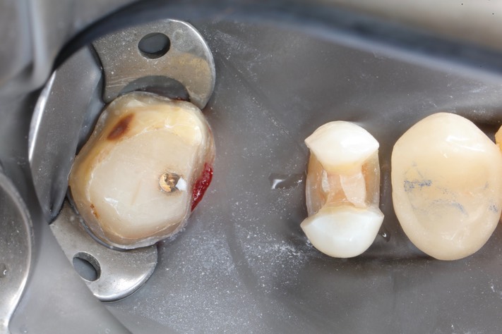 Ted Kanamori#13  & 15 prep