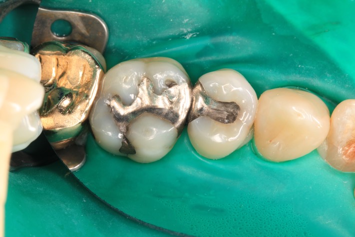 Ted Kanamori #13-14 pre-op