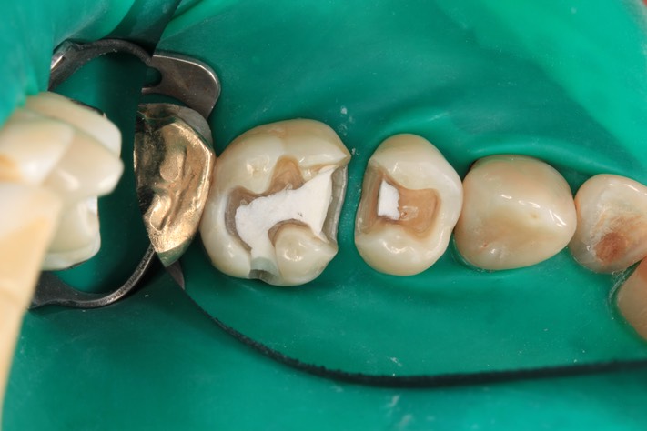 Ted Kanamori #13-14 prep