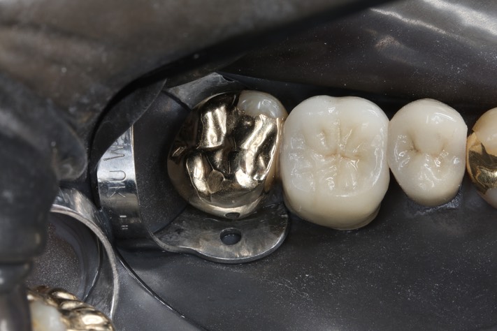 Wayne Chin #15 pre-op