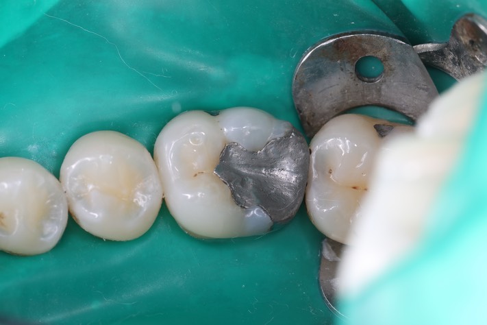 Wayne Chin #19 pre-op