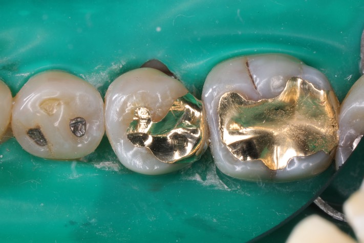 Wayne Chin #20 finish