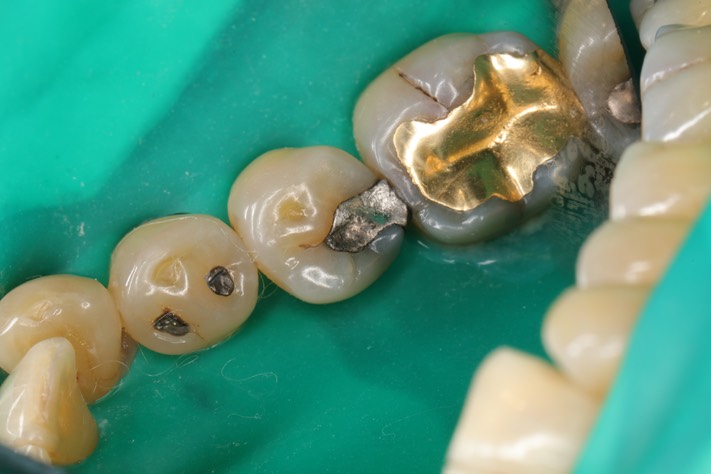 Wayne Chin #20 pre-op