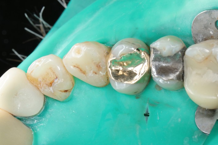 Wayne Chin #5 finish