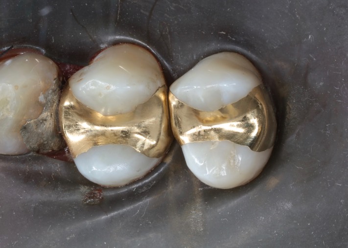 Wes Sato #4-5 finish