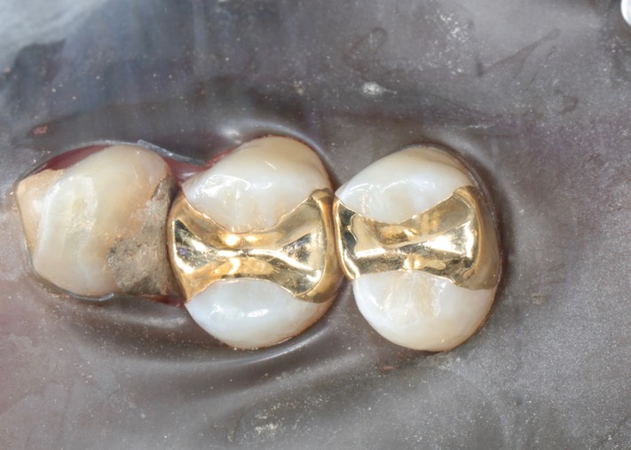 Wes Sato #4-5 try in